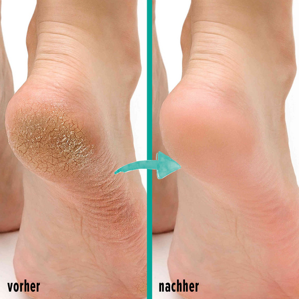 Gel-Socken rose + blau 2 Paar